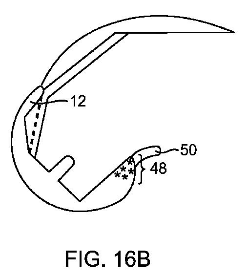 5837876-人工膝患者に深膝屈曲能力を提供するシステム及び方法 図000059