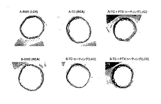 5907658-自己消失性コーティング 図000059