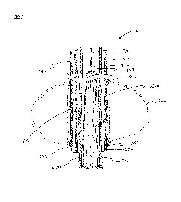6235672-粘膜下医療処置を実行するための方法及びシステム 図000059
