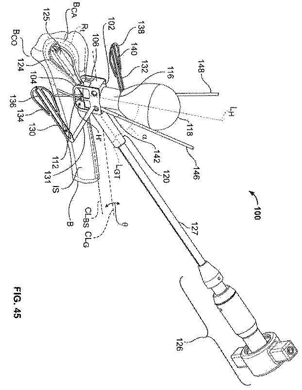 6316876-骨インプラントを固定するための装置および方法 図000059