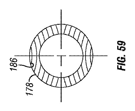 6243841-骨を治療するための封入アセンブリおよびアセンブリ 図000060