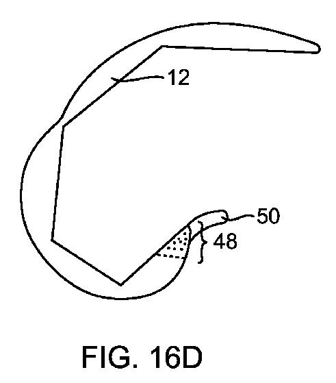 5837876-人工膝患者に深膝屈曲能力を提供するシステム及び方法 図000061