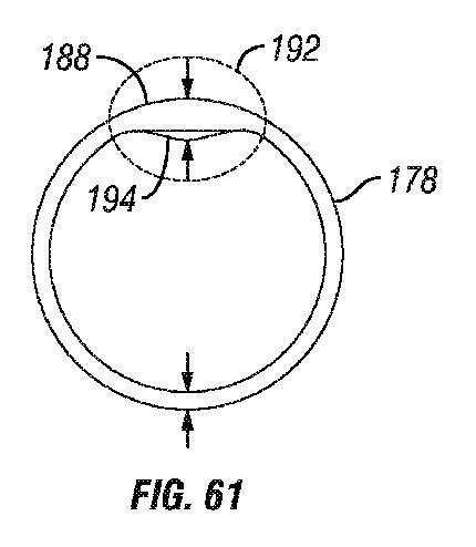 6243841-骨を治療するための封入アセンブリおよびアセンブリ 図000062