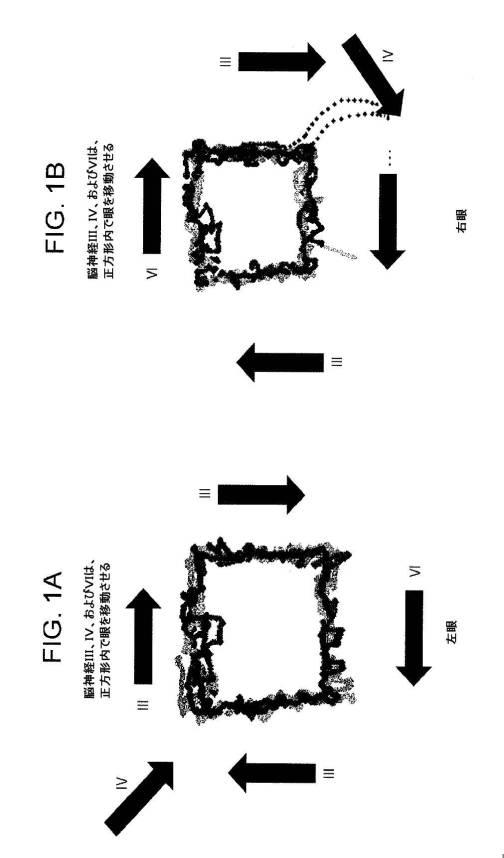 6676522-対象における眼球運動を追跡するためのデバイスの作動方法、および当該デバイスによって追跡された眼球運動のデータの中枢神経系病変を位置特定するための使用方法 図000062