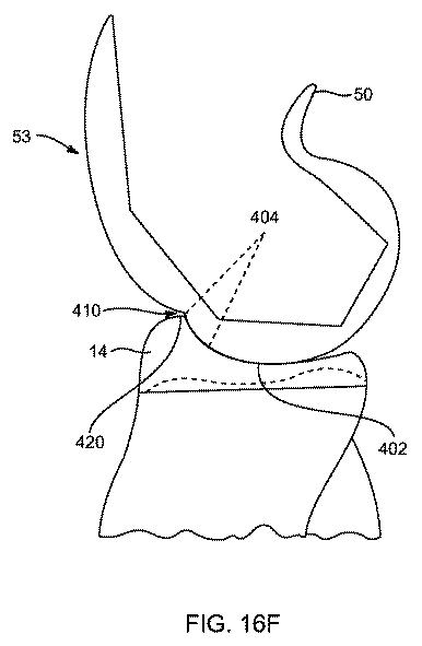 5837876-人工膝患者に深膝屈曲能力を提供するシステム及び方法 図000063