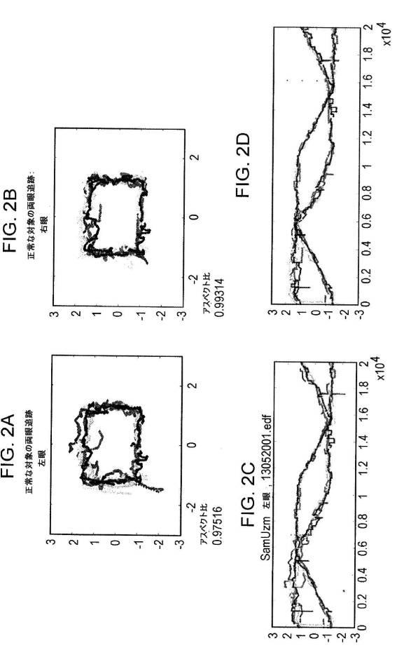 6676522-対象における眼球運動を追跡するためのデバイスの作動方法、および当該デバイスによって追跡された眼球運動のデータの中枢神経系病変を位置特定するための使用方法 図000063