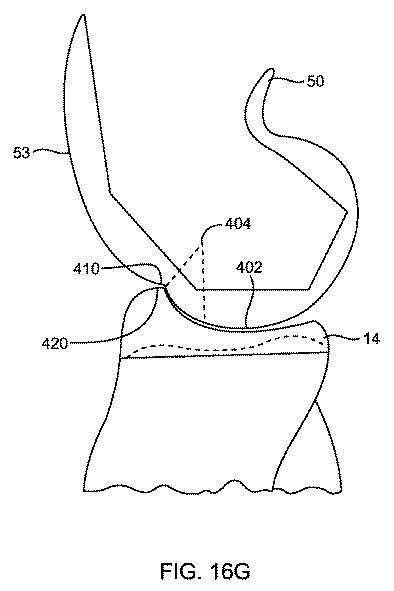 5837876-人工膝患者に深膝屈曲能力を提供するシステム及び方法 図000064