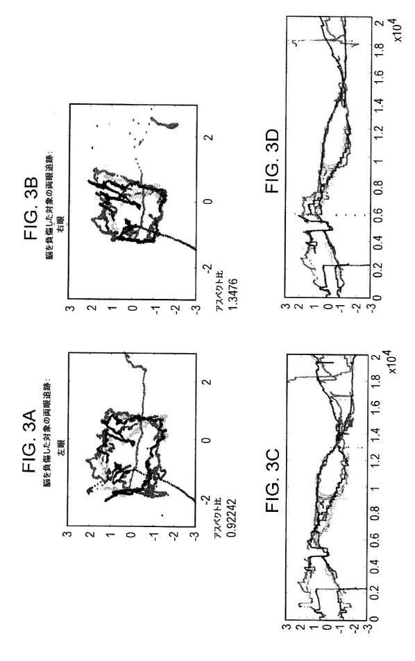 6676522-対象における眼球運動を追跡するためのデバイスの作動方法、および当該デバイスによって追跡された眼球運動のデータの中枢神経系病変を位置特定するための使用方法 図000064