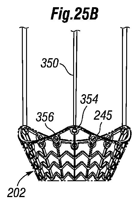 5647680-一体的な迅速接続人工心臓弁ならびに配備のシステムおよび方法 図000065