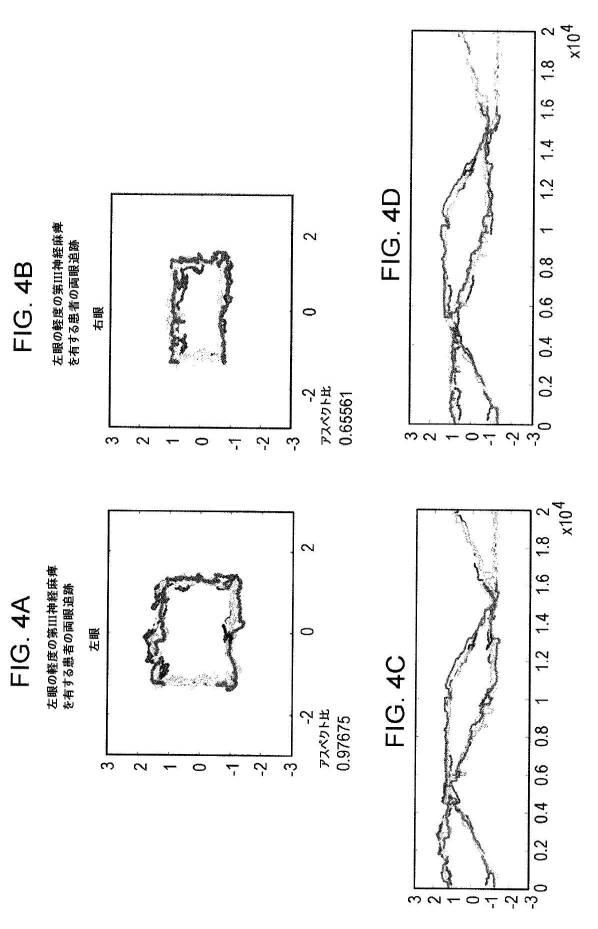 6676522-対象における眼球運動を追跡するためのデバイスの作動方法、および当該デバイスによって追跡された眼球運動のデータの中枢神経系病変を位置特定するための使用方法 図000065