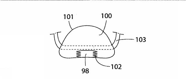 5830513-卵管内の精子の流れを制御する装置 図000066