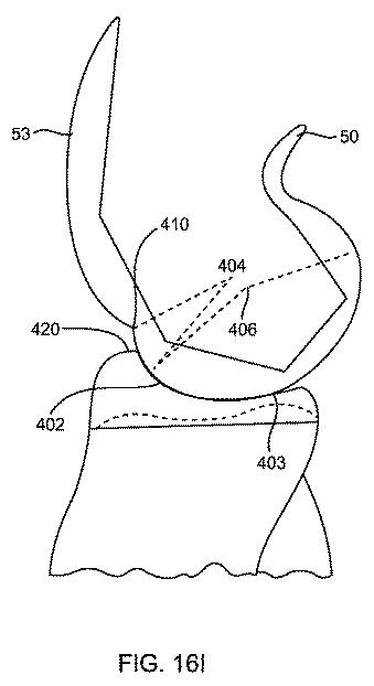 5837876-人工膝患者に深膝屈曲能力を提供するシステム及び方法 図000066