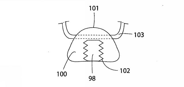 5830513-卵管内の精子の流れを制御する装置 図000067