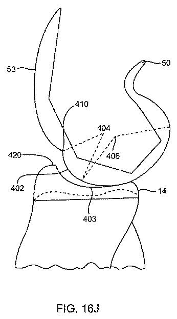 5837876-人工膝患者に深膝屈曲能力を提供するシステム及び方法 図000067