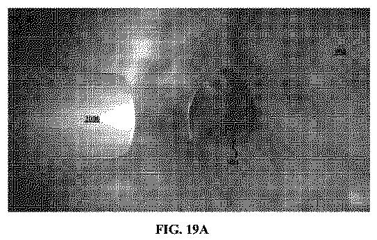 6073685-組織修復用インプラントと送達装置と送達方法 図000067