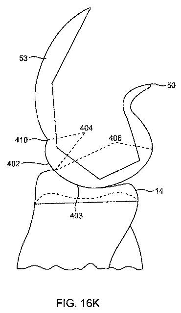 5837876-人工膝患者に深膝屈曲能力を提供するシステム及び方法 図000068