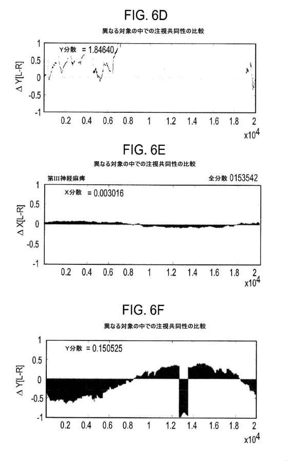 6676522-対象における眼球運動を追跡するためのデバイスの作動方法、および当該デバイスによって追跡された眼球運動のデータの中枢神経系病変を位置特定するための使用方法 図000068