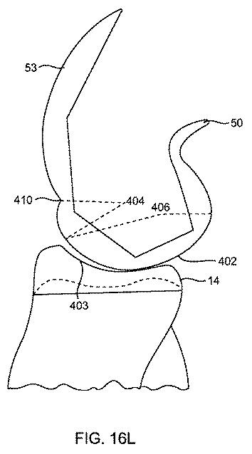 5837876-人工膝患者に深膝屈曲能力を提供するシステム及び方法 図000069