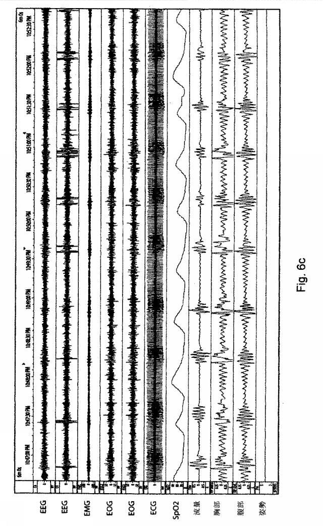 6782267-サーボ人工呼吸器、方法、及びコンピュータ可読記憶媒体 図000069