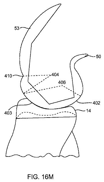 5837876-人工膝患者に深膝屈曲能力を提供するシステム及び方法 図000070