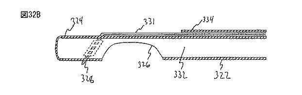 6235672-粘膜下医療処置を実行するための方法及びシステム 図000070