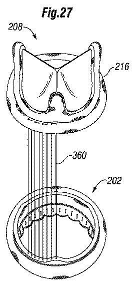 5647680-一体的な迅速接続人工心臓弁ならびに配備のシステムおよび方法 図000071