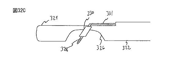 6235672-粘膜下医療処置を実行するための方法及びシステム 図000071