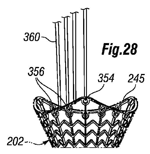 5647680-一体的な迅速接続人工心臓弁ならびに配備のシステムおよび方法 図000072