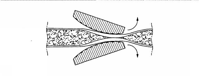 5830513-卵管内の精子の流れを制御する装置 図000072