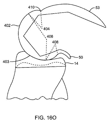 5837876-人工膝患者に深膝屈曲能力を提供するシステム及び方法 図000072