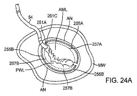 6010545-僧帽弁の修復および置換のためのシステム 図000072