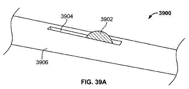 6606570-瘻を形成するためのデバイスおよび方法 図000072