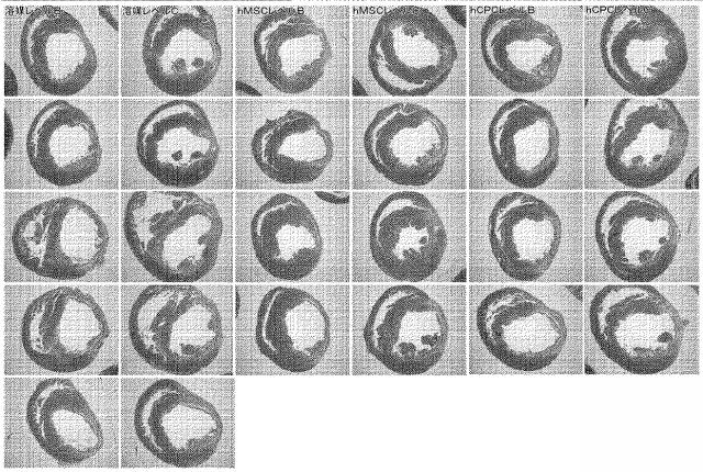 5894071-心臓組織由来細胞 図000073