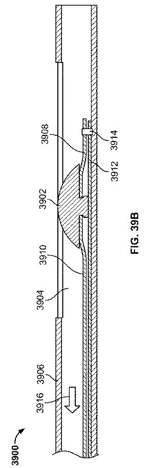 6606570-瘻を形成するためのデバイスおよび方法 図000073