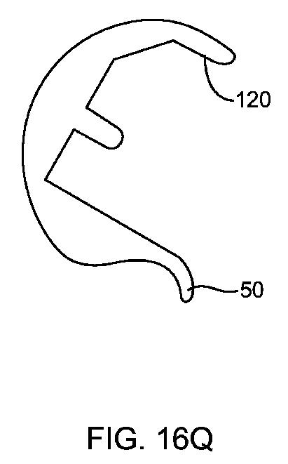 5837876-人工膝患者に深膝屈曲能力を提供するシステム及び方法 図000074