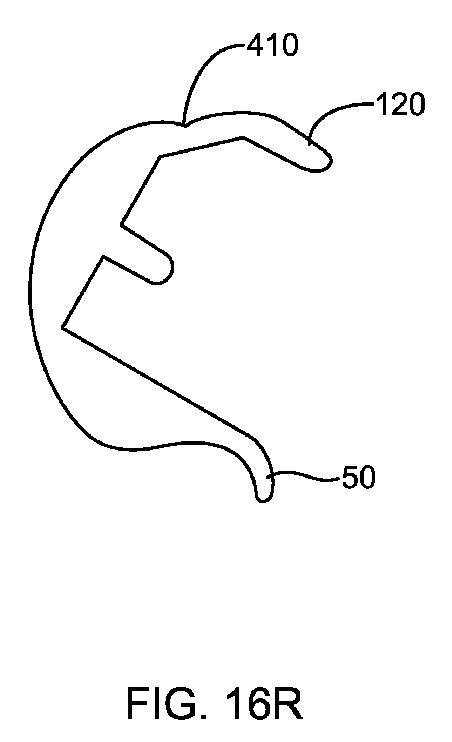 5837876-人工膝患者に深膝屈曲能力を提供するシステム及び方法 図000075