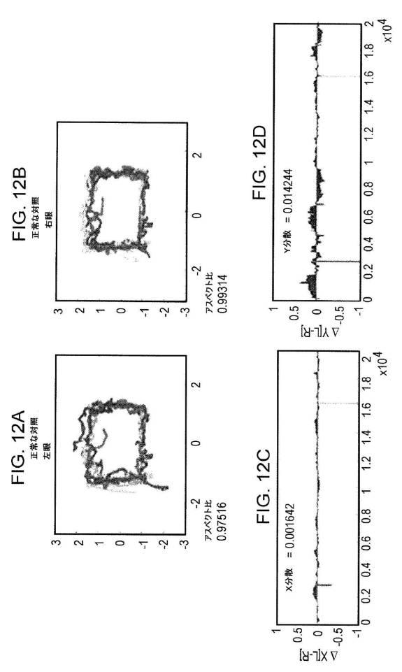 6676522-対象における眼球運動を追跡するためのデバイスの作動方法、および当該デバイスによって追跡された眼球運動のデータの中枢神経系病変を位置特定するための使用方法 図000075