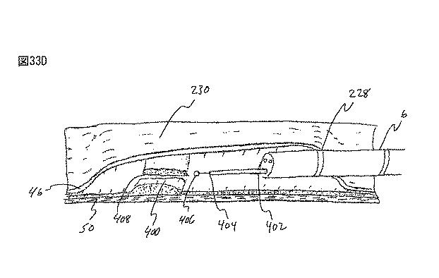 6235672-粘膜下医療処置を実行するための方法及びシステム 図000076
