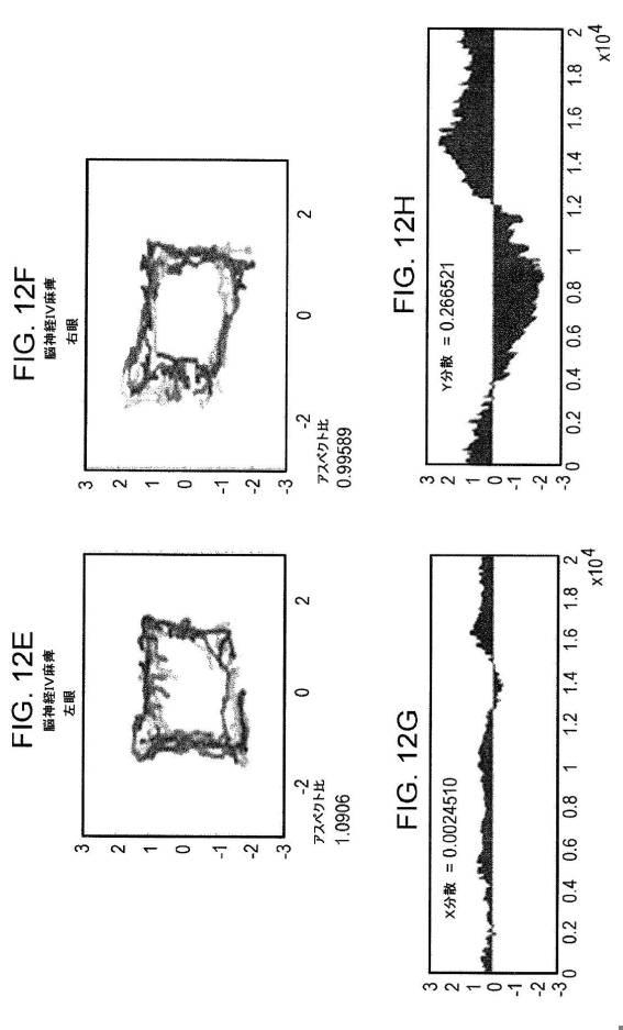 6676522-対象における眼球運動を追跡するためのデバイスの作動方法、および当該デバイスによって追跡された眼球運動のデータの中枢神経系病変を位置特定するための使用方法 図000076