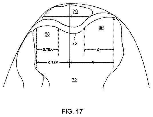 5837876-人工膝患者に深膝屈曲能力を提供するシステム及び方法 図000077