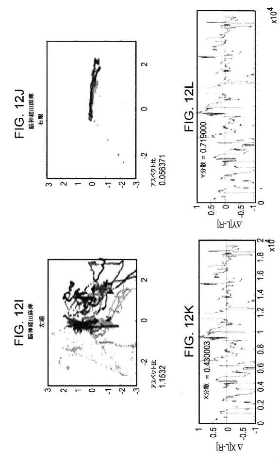 6676522-対象における眼球運動を追跡するためのデバイスの作動方法、および当該デバイスによって追跡された眼球運動のデータの中枢神経系病変を位置特定するための使用方法 図000077