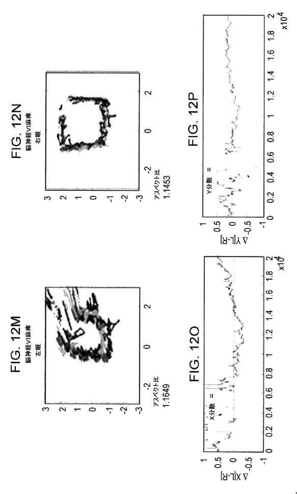 6676522-対象における眼球運動を追跡するためのデバイスの作動方法、および当該デバイスによって追跡された眼球運動のデータの中枢神経系病変を位置特定するための使用方法 図000078