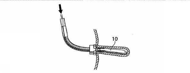 6527186-ＧＥＲＤを治療するための装置 図000079
