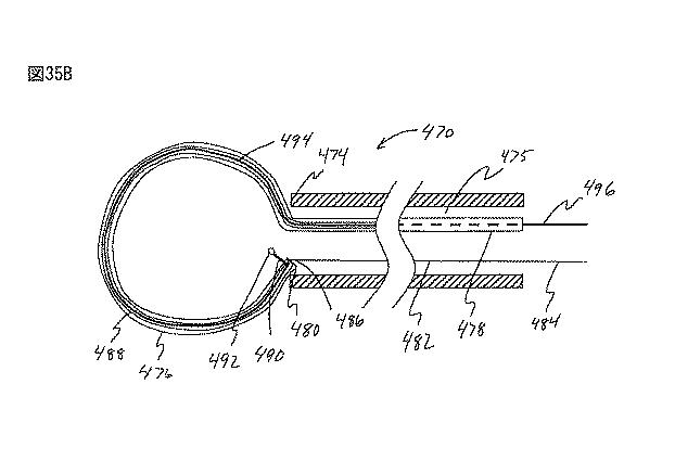 6235672-粘膜下医療処置を実行するための方法及びシステム 図000080