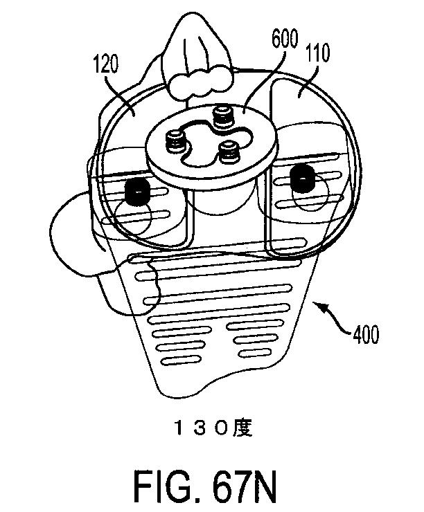 6161900-十字靭帯温存型人工膝関節 図000081