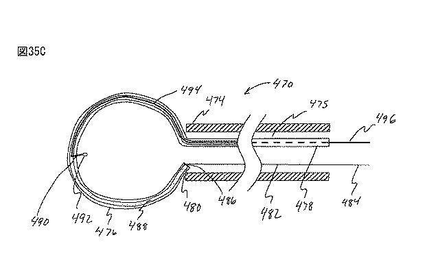 6235672-粘膜下医療処置を実行するための方法及びシステム 図000081