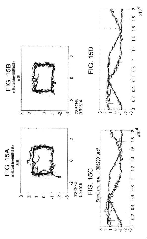 6676522-対象における眼球運動を追跡するためのデバイスの作動方法、および当該デバイスによって追跡された眼球運動のデータの中枢神経系病変を位置特定するための使用方法 図000081