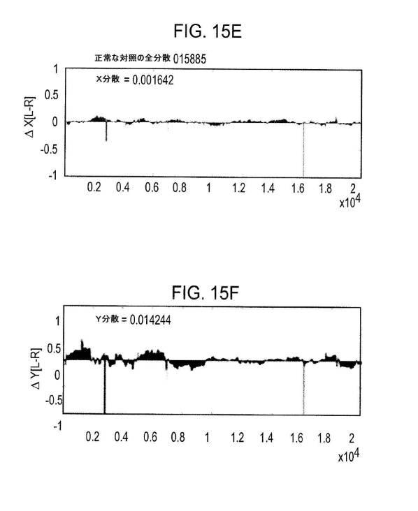 6676522-対象における眼球運動を追跡するためのデバイスの作動方法、および当該デバイスによって追跡された眼球運動のデータの中枢神経系病変を位置特定するための使用方法 図000082