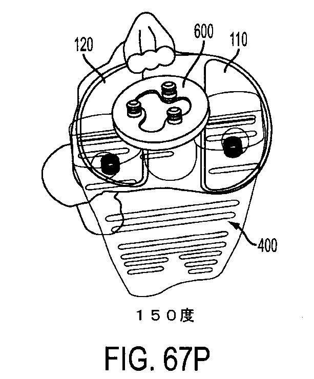 6161900-十字靭帯温存型人工膝関節 図000083