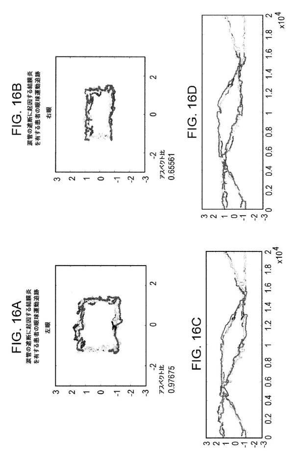 6676522-対象における眼球運動を追跡するためのデバイスの作動方法、および当該デバイスによって追跡された眼球運動のデータの中枢神経系病変を位置特定するための使用方法 図000083